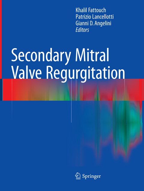 Secondary Mitral Valve Regurgitation - 