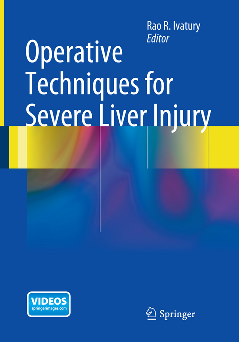 Operative Techniques for Severe Liver Injury - 