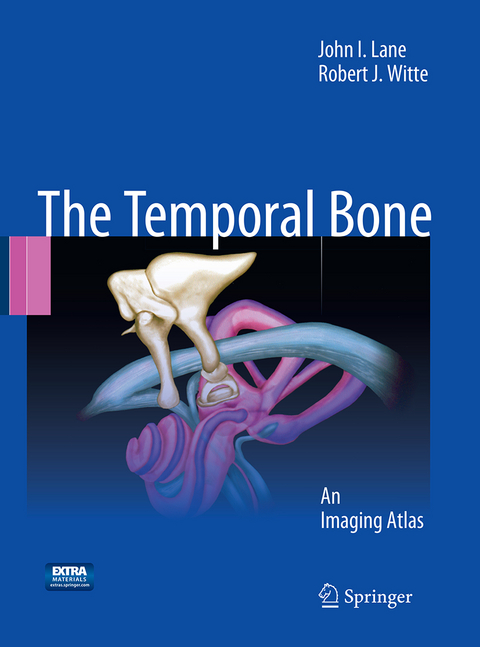 Temporal Bone - John I. Lane, Robert J. Witte