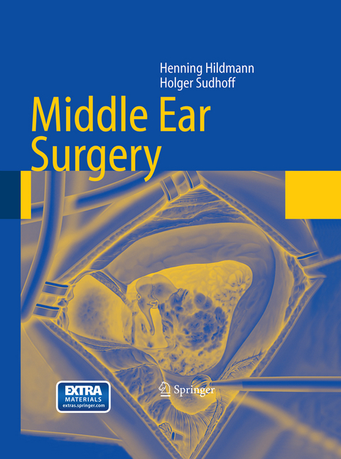 Middle Ear Surgery - Henning Hildmann, Holger Sudhoff