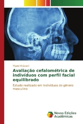 Avaliação cefalométrica de indivíduos com perfil facial equilibrado - Miguel Attizzani