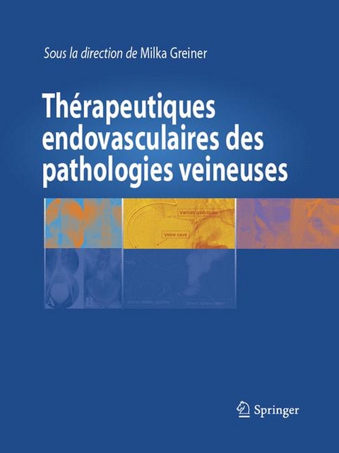 Thérapeutiques Endovasculaires Des Pathologies Veineuses - 