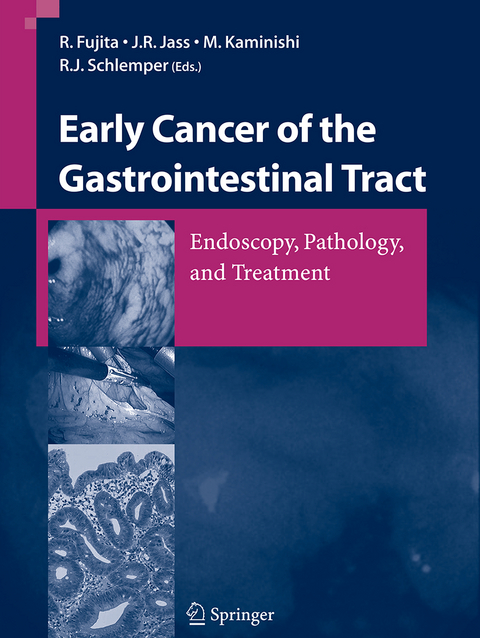 Early Cancer of the Gastrointestinal Tract - 