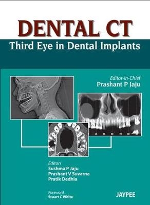 Dental CT Third Eye in Dental Implants - Prashant P Jaju