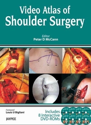 Video Atlas of Shoulder Surgery - Peter D McCann