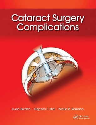 Cataract Surgery Complications - Lucio Buratto, Stephen Brint, Mario Romano