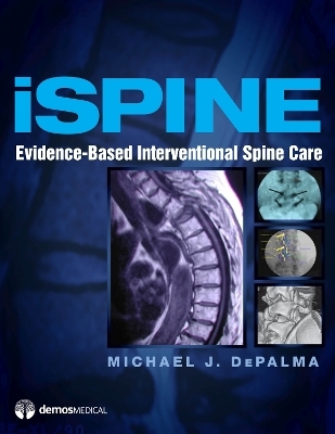 iSpine - 