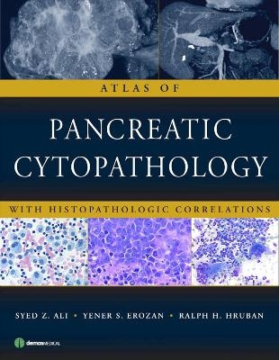 Atlas of Pancreatic Cytopathology - Syed Ali, Yener Erozan, Ralph Hruban