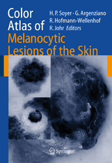 Color Atlas of Melanocytic Lesions of the Skin - 