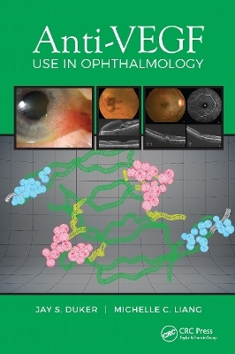 Anti-VEGF Use in Ophthalmology - Jay Duker, Michelle Liang