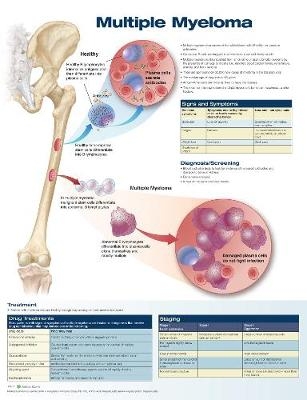 Multiple Myeloma