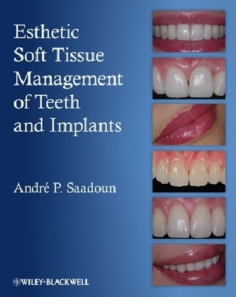 Esthetic Soft Tissue Management of Teeth and Implants - Andre P. Saadoun