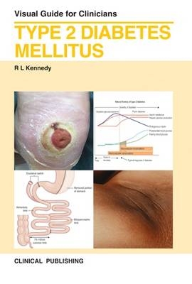 Type 2 Diabetes Mellitus - 