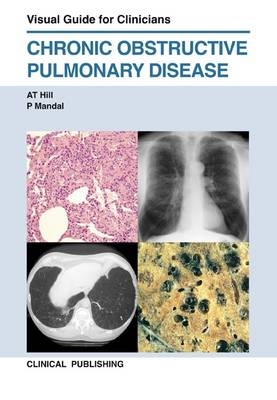 COPD: Visual Guide for Clinicians - 