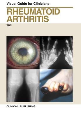 Rheumatoid Arthritis -  Tak