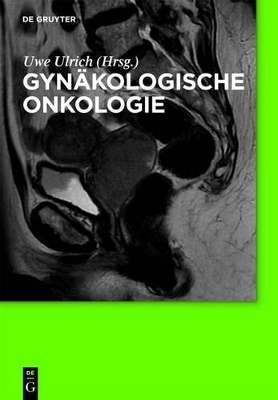 Gynäkologische Onkologie - 