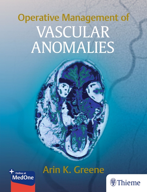 Operative Management of Vascular Anomalies - 