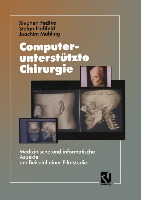 Computerunterstützte Chirurgie - Stephen Fedtke