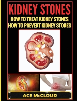 Kidney Stones - Ace McCloud