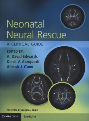 Neonatal Neural Rescue - 