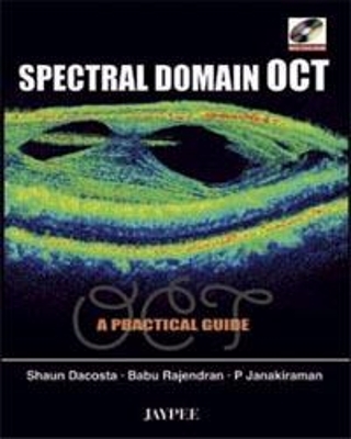 Spectral Domain OCT - Shaun Dacosta