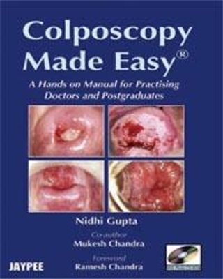 Colposcopy Made Easy - Nidhi Gupta