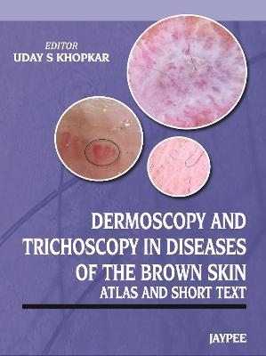 Dermoscopy and Trichoscopy in Diseases of the Brown Skin - 