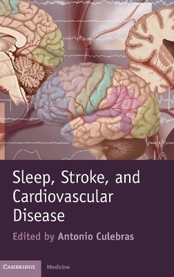 Sleep, Stroke and Cardiovascular Disease - 