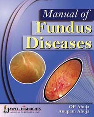 Manual of Fundus Diseases - OP Ahuja, Anupam Ahuja