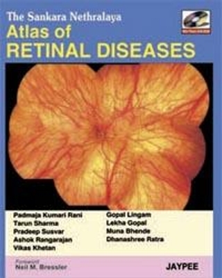 The Sankara Nethralaya Atlas of Retinal Diseases - PK Rani