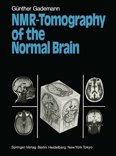 NMR-Tomography of the Normal Brain - Günther Gademann