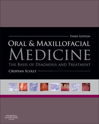 Oral and Maxillofacial Medicine - Crispian Scully