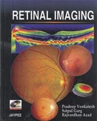 Retinal Imaging - Pradeep Venkatesh, Satpal Garg, Raj Vardhan Azad