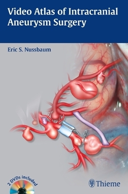 Video Atlas of Intracranial Aneurysm Surgery - Eric S. Nussbaum