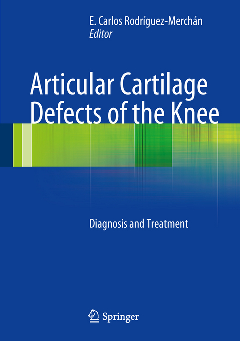 Articular Cartilage Defects of the Knee - 