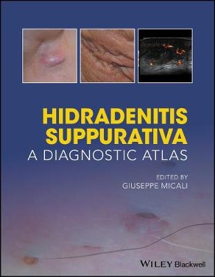 Hidradenitis Suppurativa – A Diagnostic Atlas - 