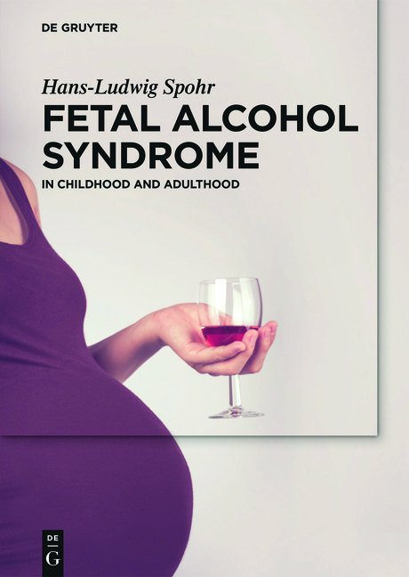 Fetal Alcohol Syndrome - Hans-Ludwig Spohr