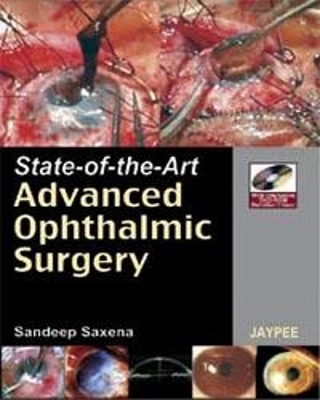 State-of-the Art Advanced Ophthalmic Surgery - Sandeep Saxena