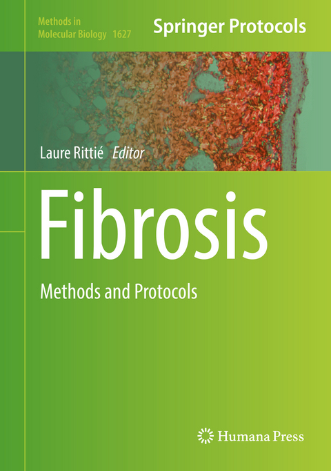 Fibrosis - 