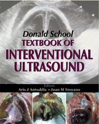 Donald School Textbook of Interventional Ultrasound - AJ Antsaklis, JM Troyano, Frank A Chervenak