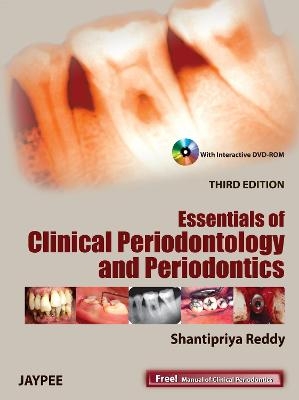 Essentials of Clinical Periodontology and Periodontics - Shantipriya Reddy