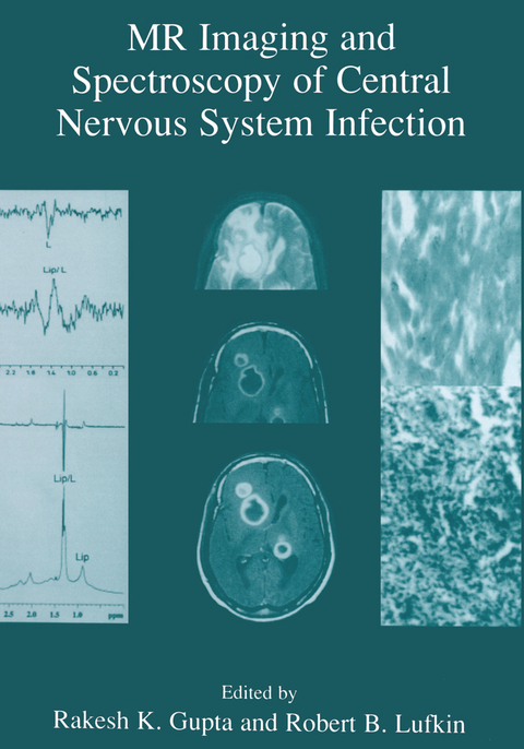 MR Imaging and Spectroscopy of Central Nervous System Infection - 