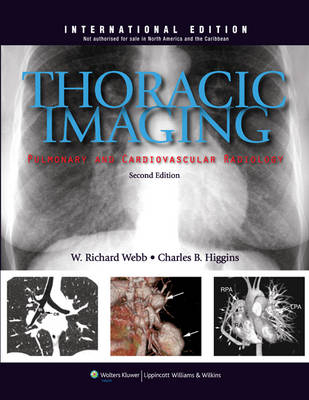 Thoracic Imaging - W. Richard Webb, Charles B. Higgins