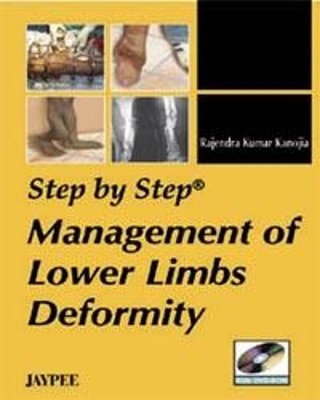 Step by Step: Management of Lower Limbs Deformity - RK Kanojia