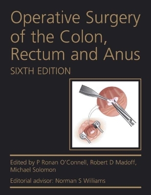 Operative Surgery of the Colon, Rectum and Anus - P Ronan O'Connell, Robert D. Madoff, Michael Solomon