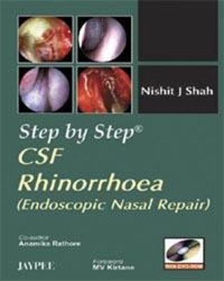 Step by Step: CSF Rhinorrhoea: Endoscopic Nasal Repair - Nishit J Shah