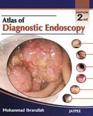 Atlas of Diagnostic Endoscopy - Mohammad Ibrarullah