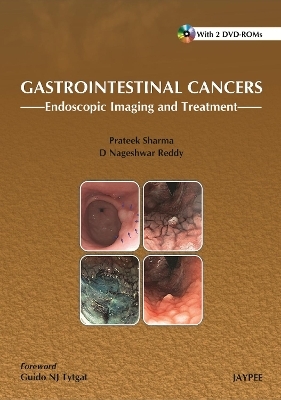 Gastrointestinal Cancers: - 