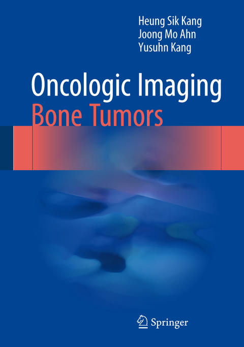 Oncologic Imaging: Bone Tumors - Heung Sik Kang, Joong Mo Ahn, Yusuhn Kang