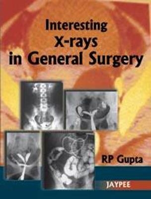 Interesting X-Rays in General Surgery - Rp Gupta